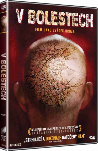 detail V bolestech - DVD